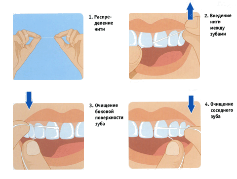 схема чистки зубов2